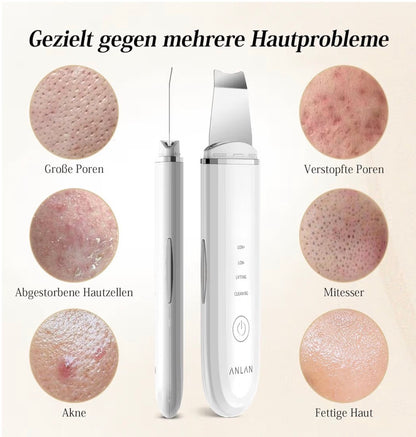 Myraskin SkinReset Pro™